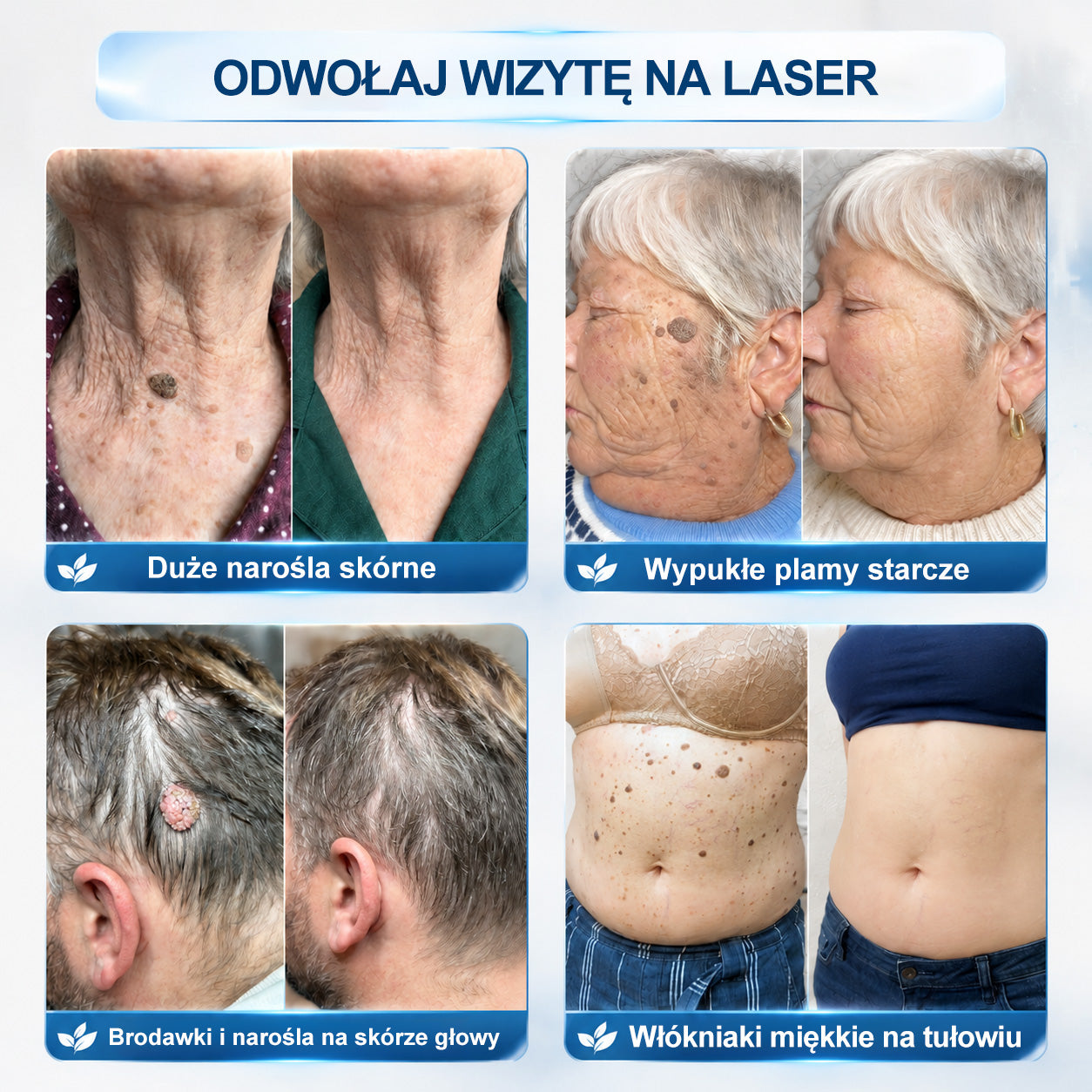 𝐏𝓲𝐜𝐝𝓸® ⭐🐳7 𝑫𝒏𝒊 𝑷𝒓𝒆𝒑𝒂𝒓𝒂𝒕 𝑫𝒐 𝑼𝒔𝒖𝒘𝒂𝒏𝒊𝒂 𝑾łó𝒌𝒏𝒊𝒂𝒌ó𝒘 𝑴𝒊ę𝒌𝒌𝒊𝒄𝒉 𝑰 𝑷𝒓𝒛𝒆𝒃𝒂𝒓𝒘𝒊𝒆ń(𝐁𝐞𝐳 𝐁ó𝐥𝐮, 𝐁𝐞𝐳 𝐁𝐥𝐢𝐳𝐧 – 𝐑𝐨𝐥𝐥-𝐨𝐧)💪