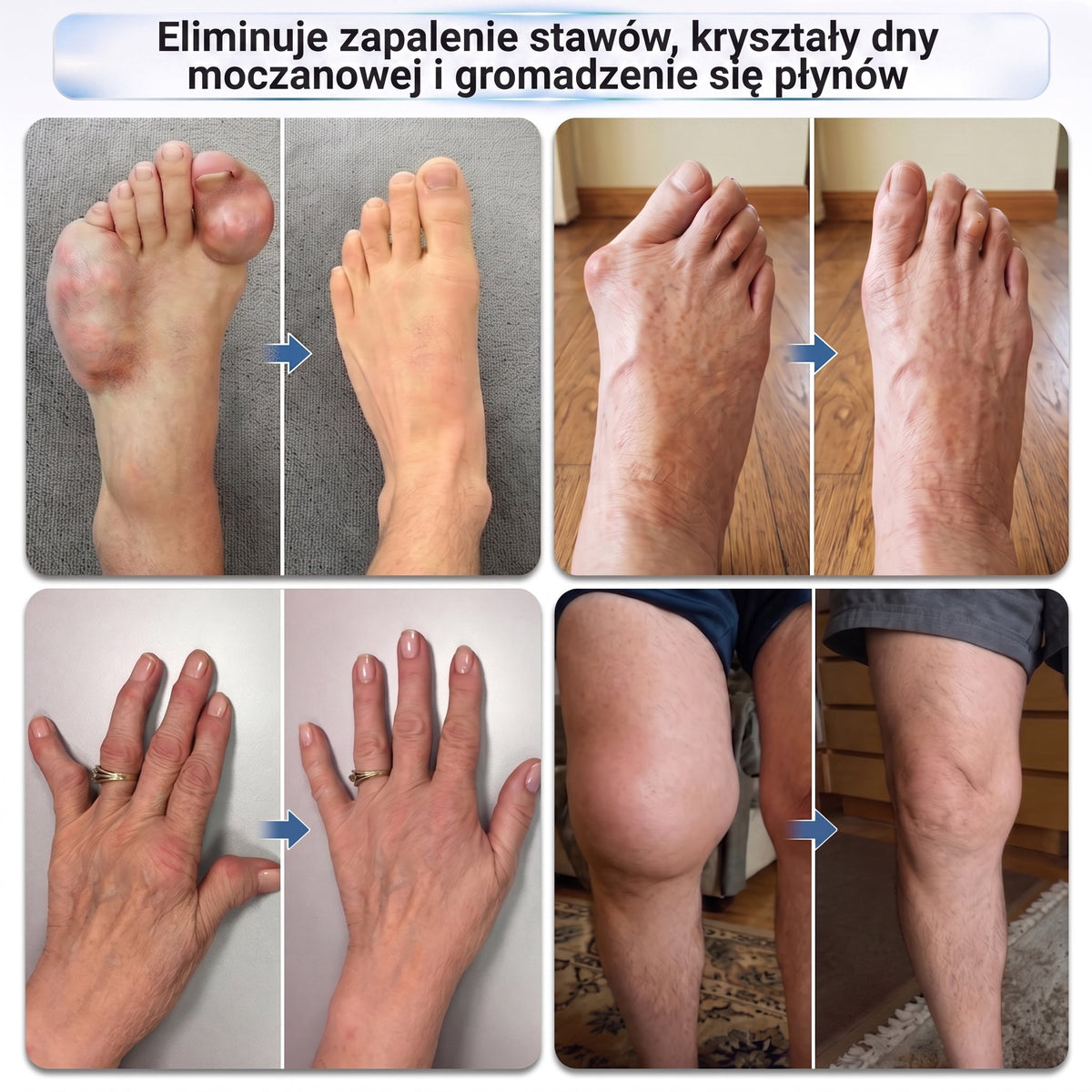 𝑿𝑹𝑳𝑿𝑹𝑳® Roller mikroigłowy 0,05 mm do regeneracji kości i stawów 🧑‍⚕️ (Dla wszystkich dorosłych, kobiet i mężczyzn – kompleksowa pielęgnacja przy różnych problemach ze stawami)
