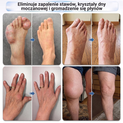 𝑿𝑹𝑳𝑿𝑹𝑳® Roller mikroigłowy 0,05 mm do regeneracji kości i stawów 🧑‍⚕️ (Dla wszystkich dorosłych, kobiet i mężczyzn – kompleksowa pielęgnacja przy różnych problemach ze stawami)