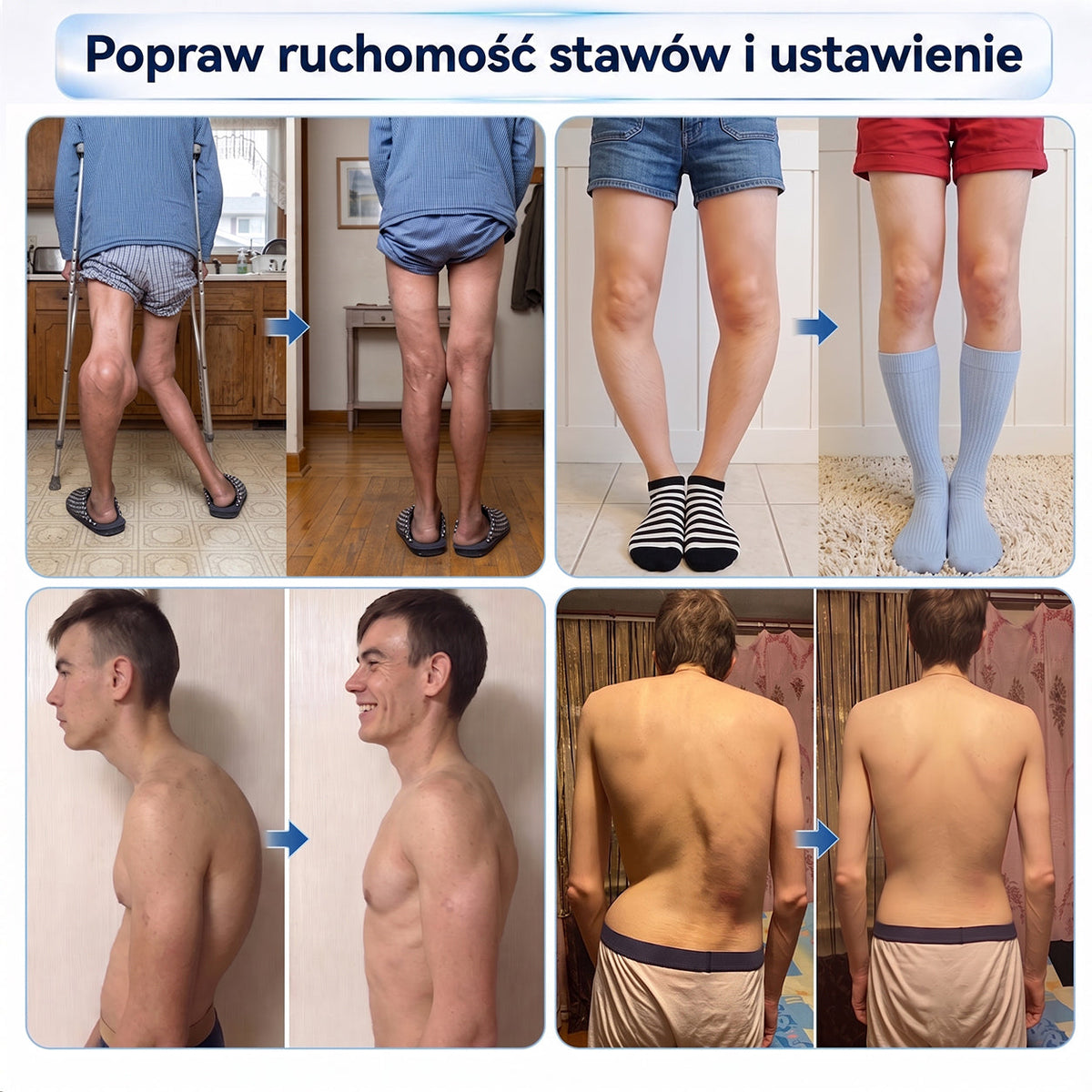 𝑿𝑹𝑳𝑿𝑹𝑳® Roller mikroigłowy 0,05 mm do regeneracji kości i stawów 🧑‍⚕️ (Dla wszystkich dorosłych, kobiet i mężczyzn – kompleksowa pielęgnacja przy różnych problemach ze stawami)